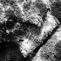 Apnea