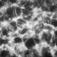 Apnea
