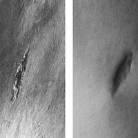 Bodyscapes